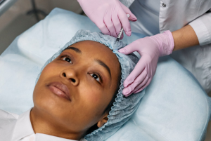 forehead filler
